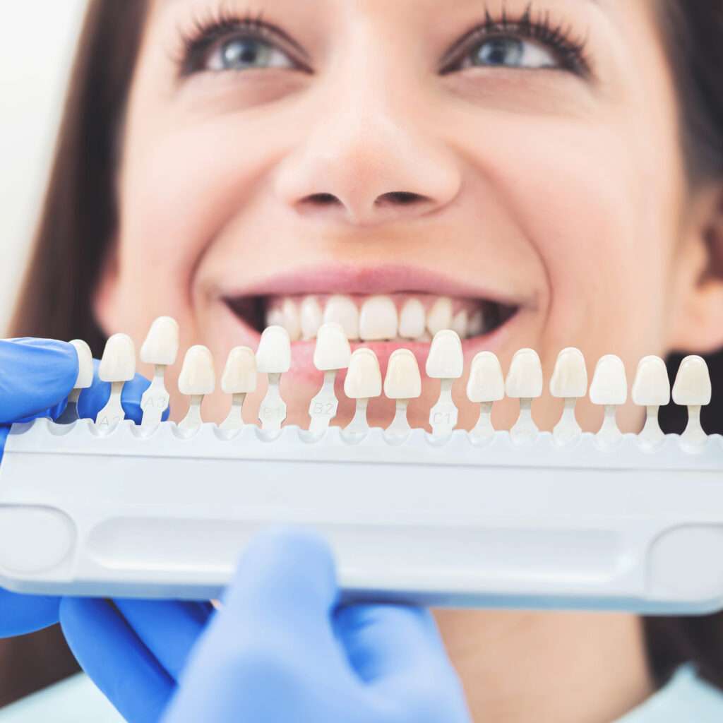Bonita sonrisa y dientes blancos