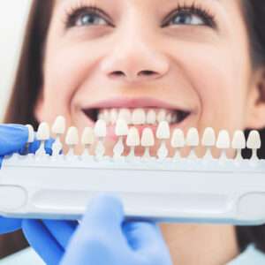 Un beau sourire et des dents blanches
