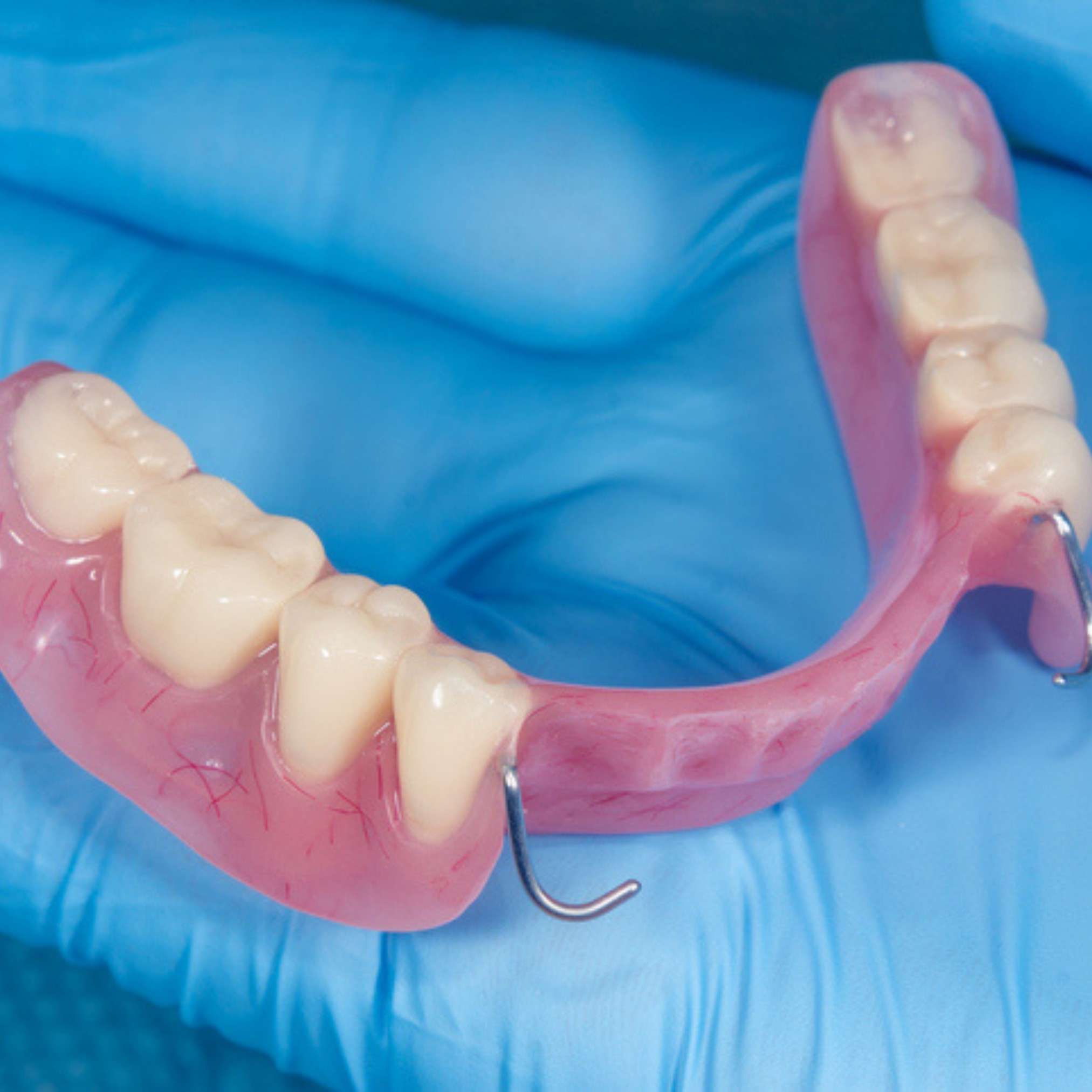 What are fixed and removable dentures for teeth replacement?