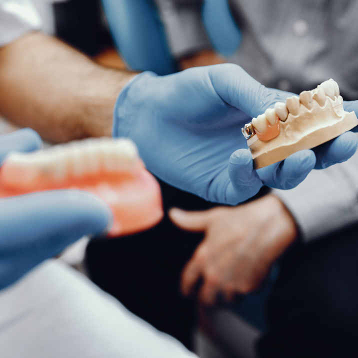Different materials for full mouth implant rehabilitation