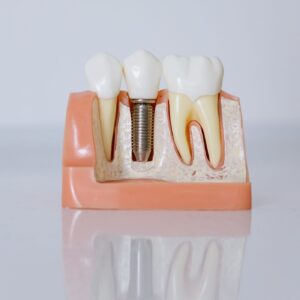 Implant dentar tăiat