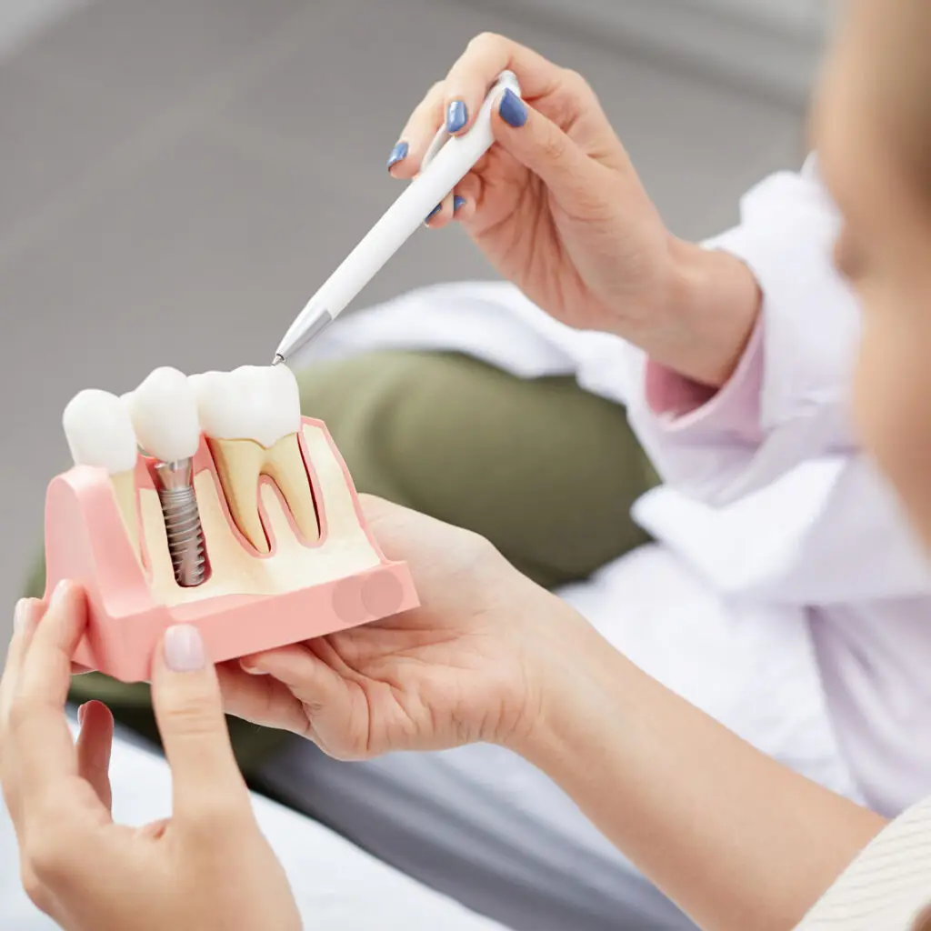 Opleiding tandheelkundige implantaten