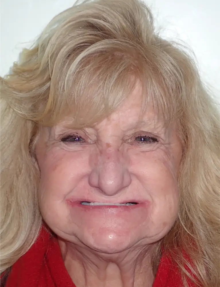 Tammy - Patient Personal Story - Success Story