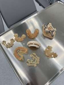 Guide chirurgiche per impianti dentali - Chirurgia guidata