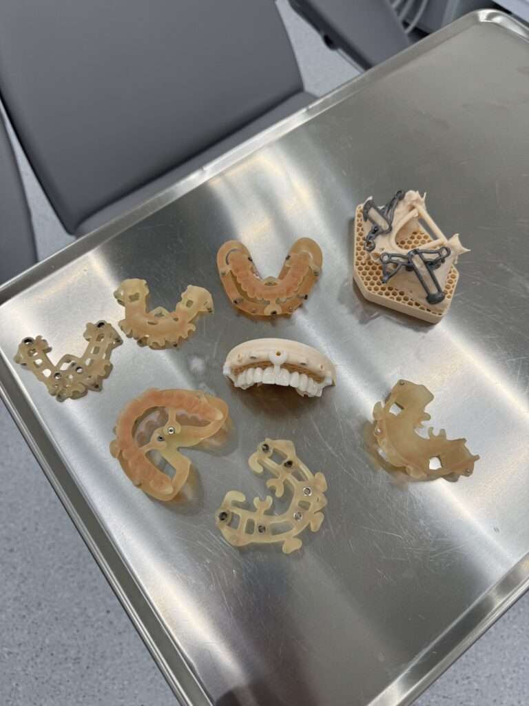 Guide chirurgiche per impianti dentali - Chirurgia guidata