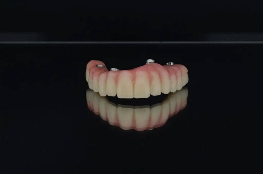Prosthesis made for patient Bruce Colleman - Patient personal stories