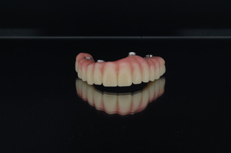 Протез, изготовленный для пациента Брюса Коллемана - Личные истории пациентов