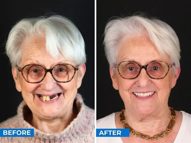 Smile 24h Paris Patient Case of Patient Transformation 1