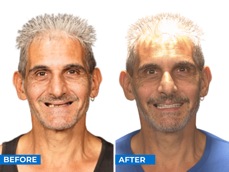 Smile 24h Victoria Patient Case of Patient Transformation 3