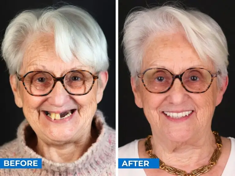 Smile 24h Paris Patient Case of Patient Transformation 2