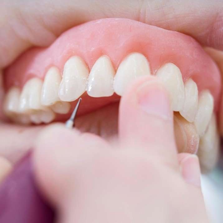 Final Touch Denture