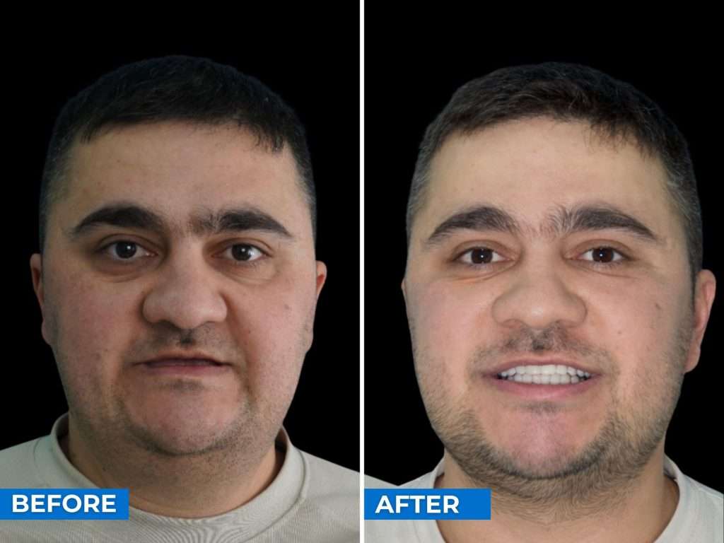 Smile Transformation Moscow North